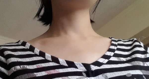 birthday多醣體纖維體膜