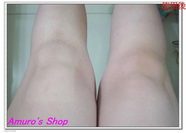 birthday多醣體纖維體膜