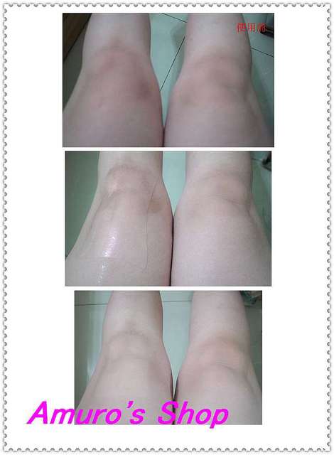 birthday多醣體纖維體膜