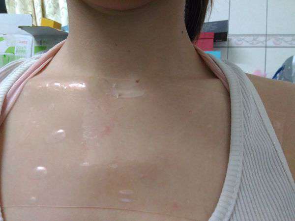 birthday多醣體纖維體膜