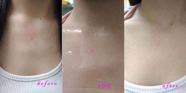 birthday多醣體纖維體膜