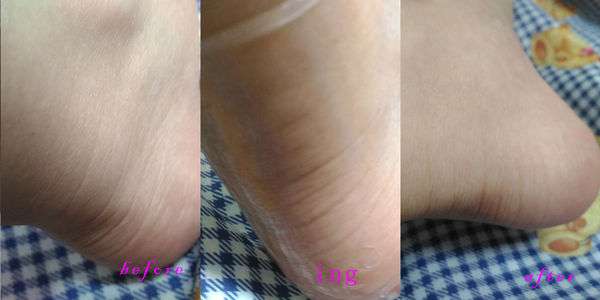 birthday多醣體纖維體膜