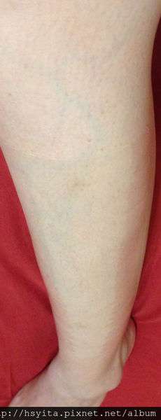 birthday多醣體纖維體膜