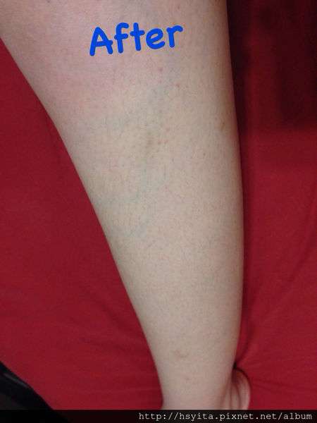 birthday多醣體纖維體膜