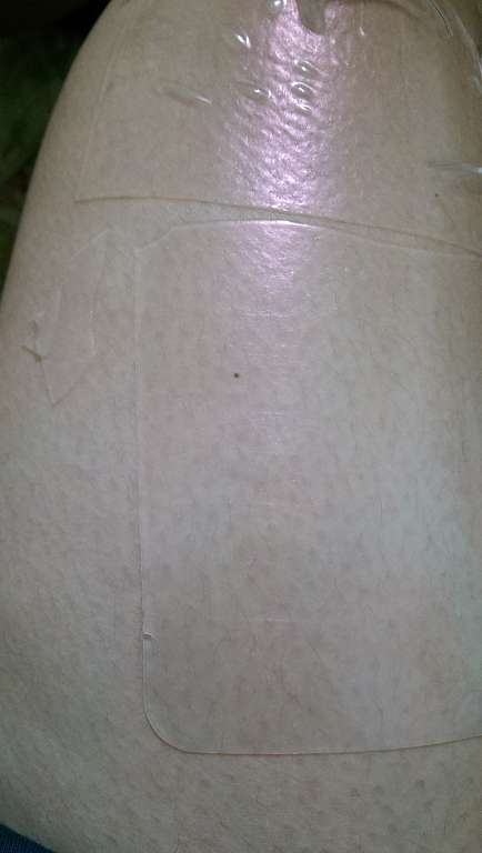 birthday多醣體纖維體膜