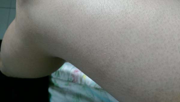 birthday多醣體纖維體膜