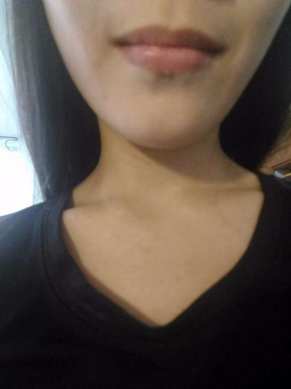 birthday多醣體纖維體膜