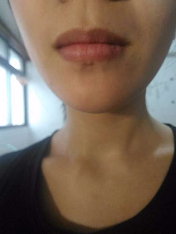 birthday多醣體纖維體膜