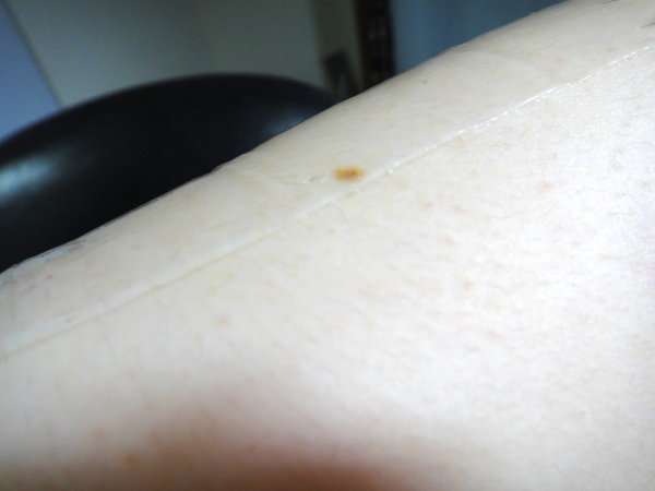 女人 知己 試用 大隊 chialo birthday 多醣體 纖維 體膜 王祚軒 醫生 推薦