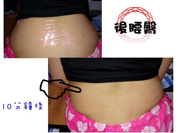 birthday多醣體纖維體膜