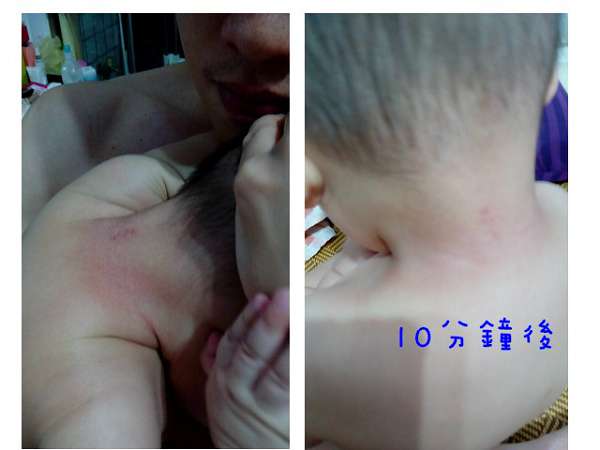 birthday多醣體纖維體膜