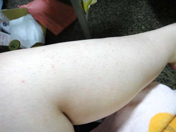 女人 知己 試用 大隊 chialo birthday 多醣體 纖維 體膜 王祚軒 醫生 推薦