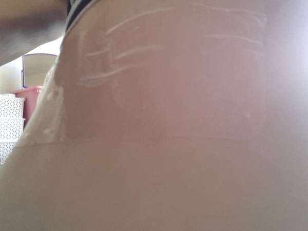 birthday多醣體纖維體膜