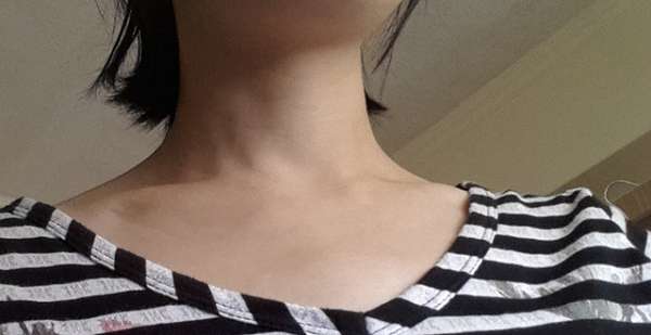 birthday多醣體纖維體膜