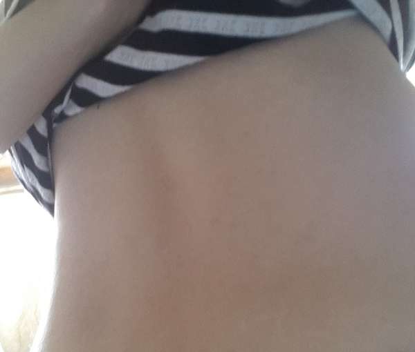 birthday多醣體纖維體膜