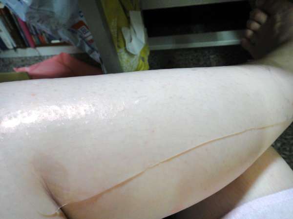 女人 知己 試用 大隊 chialo birthday 多醣體 纖維 體膜 王祚軒 醫生 推薦