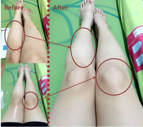 birthday多醣體纖維體膜