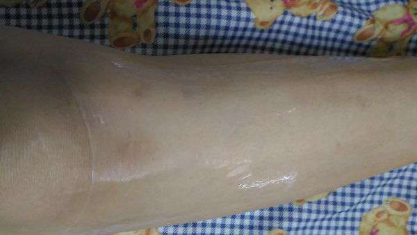 birthday多醣體纖維體膜