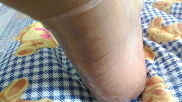 birthday多醣體纖維體膜