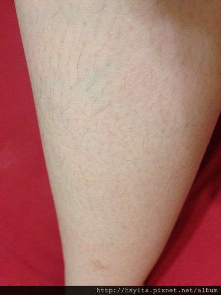 birthday多醣體纖維體膜