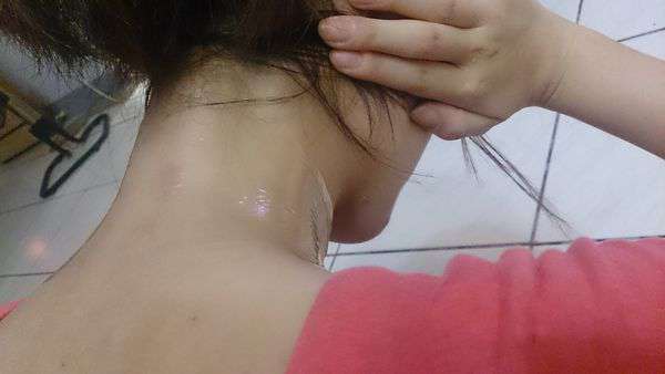 birthday多醣體纖維體膜