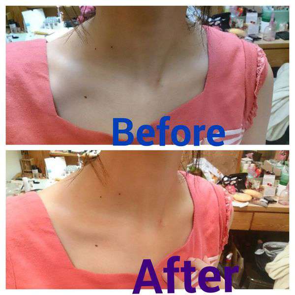 birthday多醣體纖維體膜