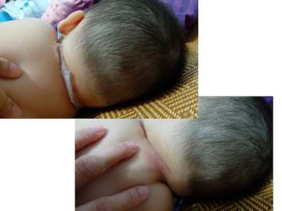 birthday多醣體纖維體膜