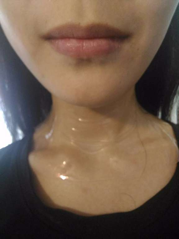 birthday多醣體纖維體膜