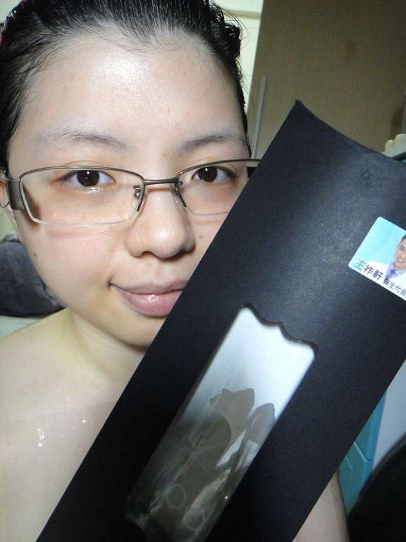 女人 知己 試用 大隊 chialo birthday 多醣體 纖維 體膜 王祚軒 醫生 推薦