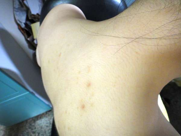 女人 知己 試用 大隊 chialo birthday 多醣體 纖維 體膜 王祚軒 醫生 推薦