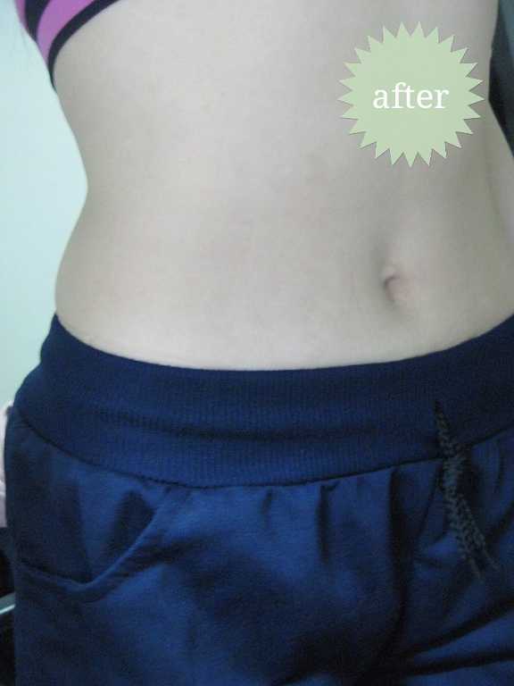 明奕蘆薈+木寡糖