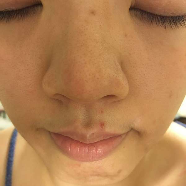 康萃美活雪白丸