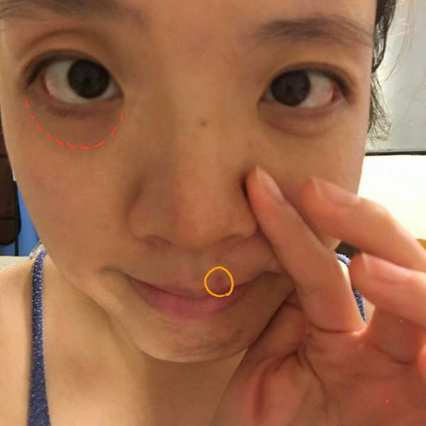 康萃美活雪白丸