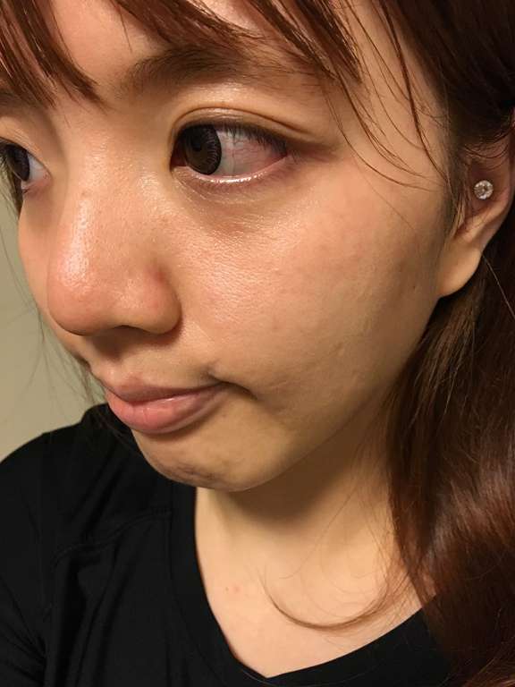 康萃美活雪白丸