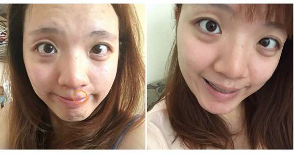 康萃美活雪白丸