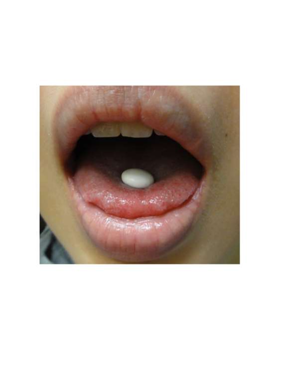 女人知己 試用 BeeZin 康萃 美活 雪白 丸 