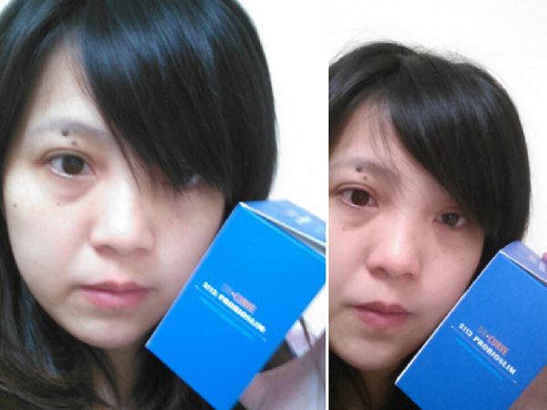 Dr.CurveS113專利乳酸菌