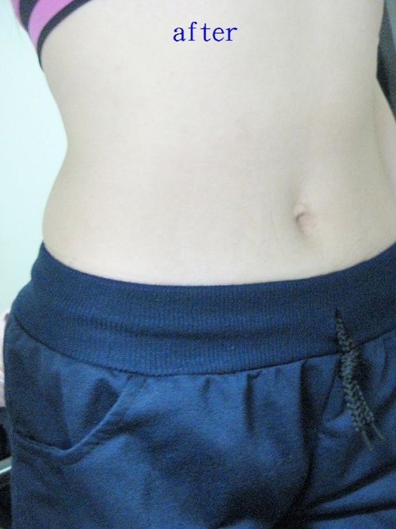 Dr.CurveS113專利乳酸菌