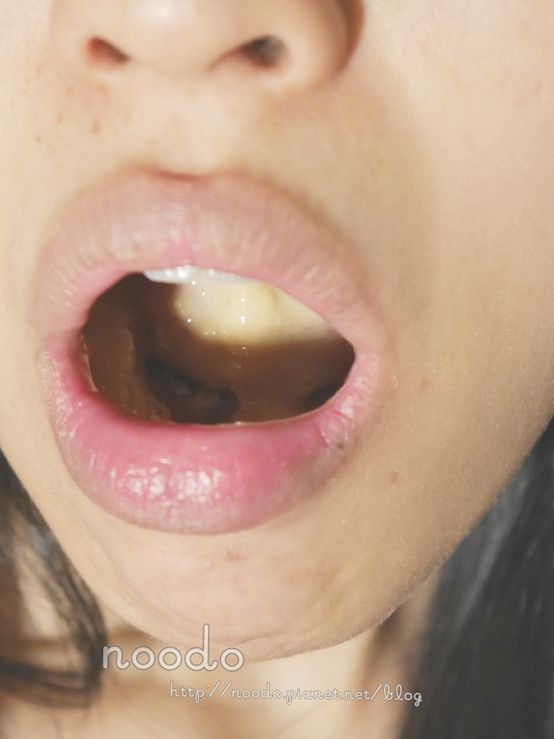 Dr.CurveS113專利乳酸菌