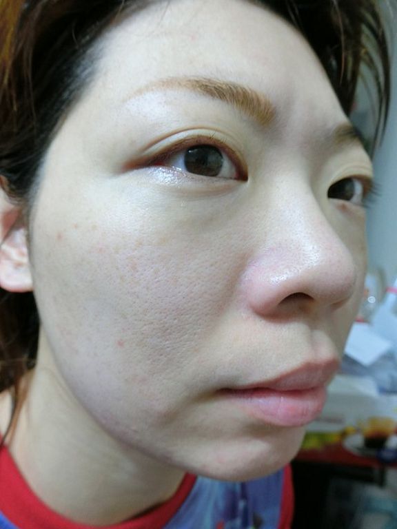 AMIINO安美諾高效抗痘凝膠