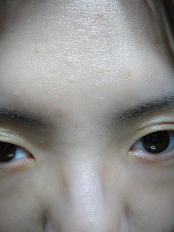 AMIINO安美諾高效抗痘凝膠