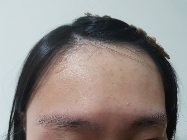 AMIINO安美諾高效抗痘凝膠