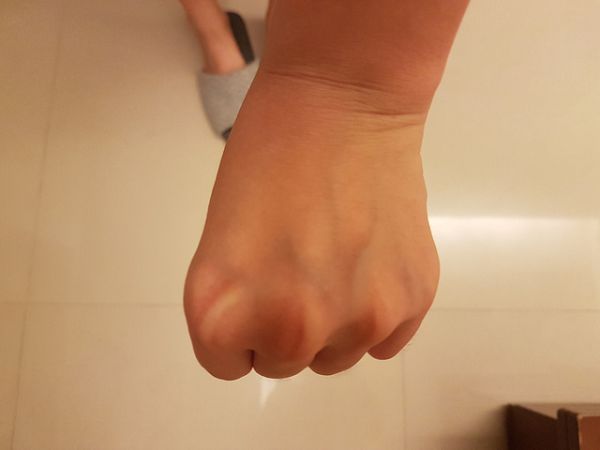 AMIINO安美諾高效抗痘凝膠