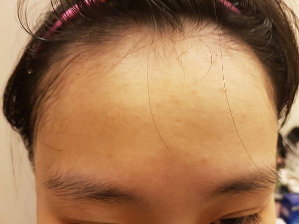 AMIINO安美諾高效抗痘凝膠