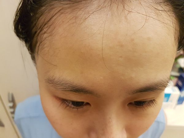 AMIINO安美諾高效抗痘凝膠