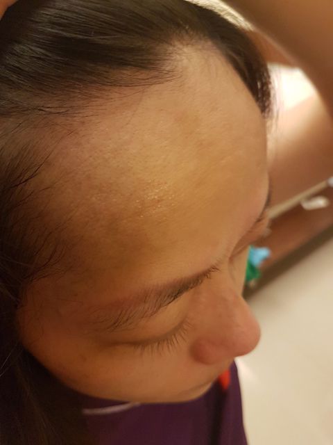 AMIINO安美諾高效抗痘凝膠