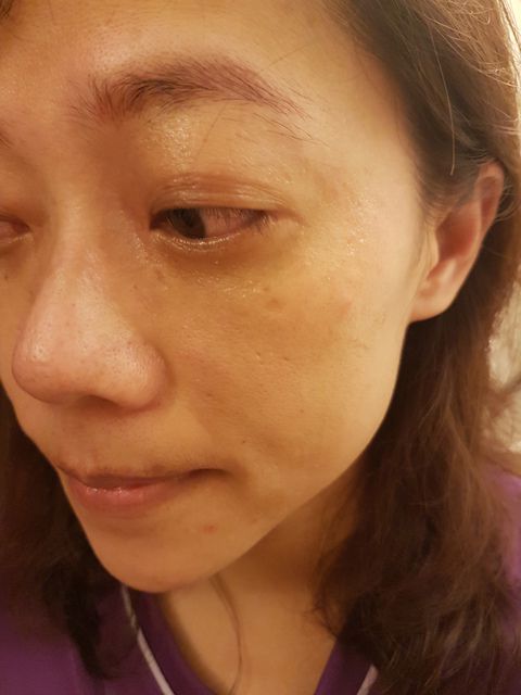 AMIINO安美諾高效抗痘凝膠