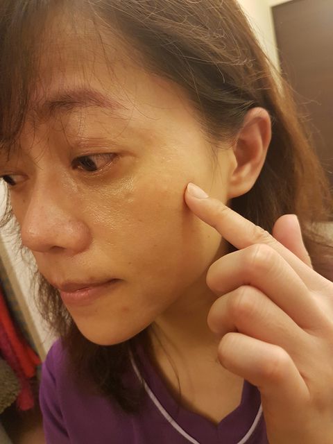 AMIINO安美諾高效抗痘凝膠