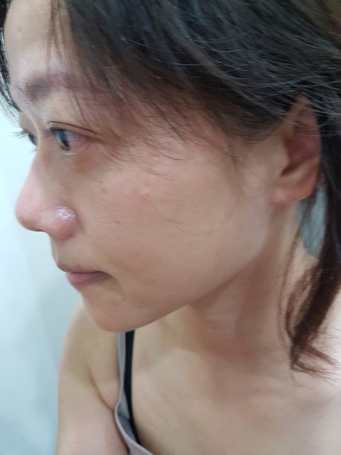 AMIINO安美諾高效抗痘凝膠