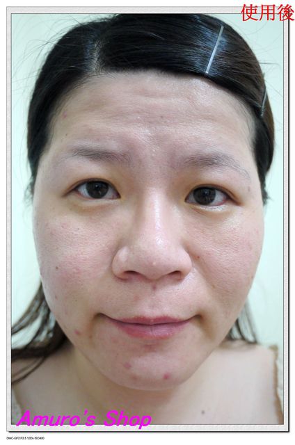 AMIINO安美諾高效抗痘凝膠